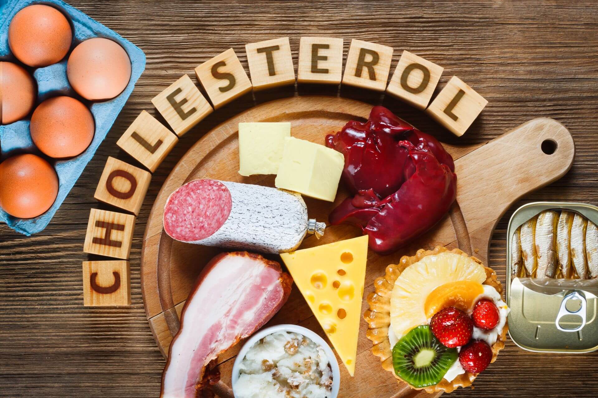 nieoczywiste przyczyny wysokiego cholesterolu we krwi 1 - Плохой холестерин — что это такое и как снизить его уровень в крови?
